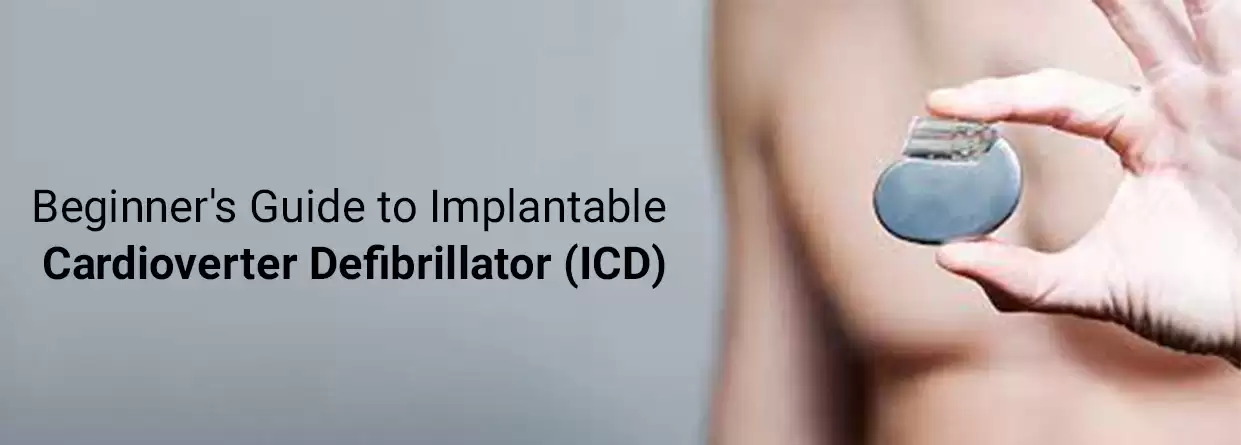Beginner's Guide to Implantable Cardioverter Defibrillator (ICD)