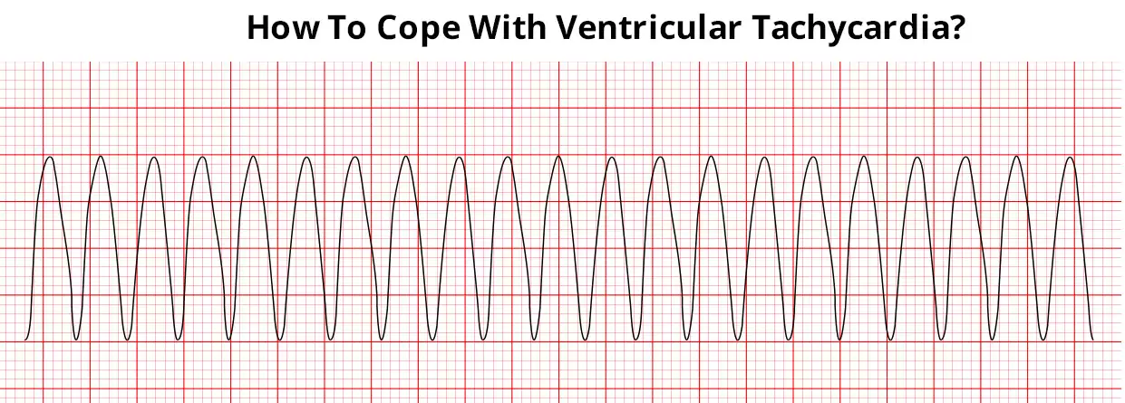 How To Cope With Ventricular Tachycardia?