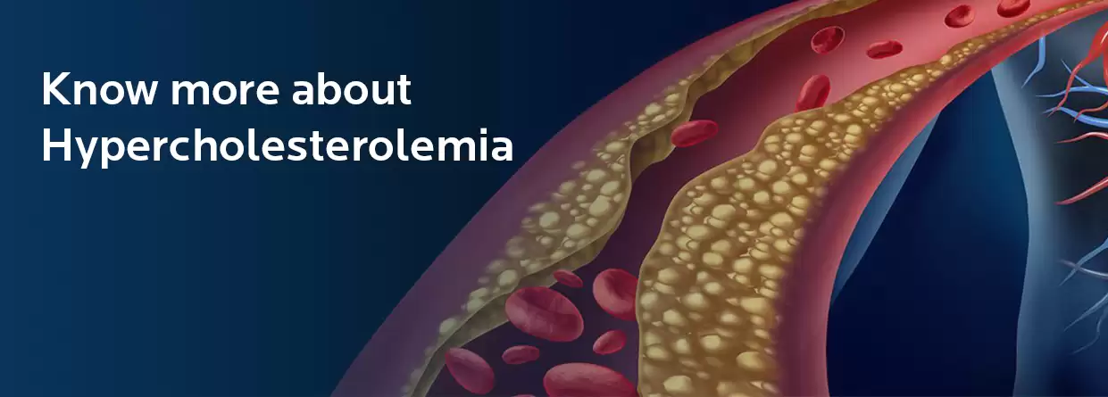 All You Need to Know About Hypercholesterolemia