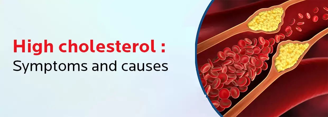 High Cholesterol: Your Ultimate Guide to Symptoms, Causes, & Treatment