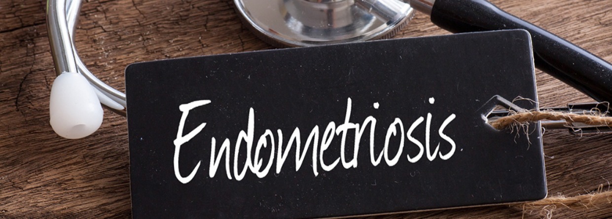 Know all about Endometriosis - A cause for concern