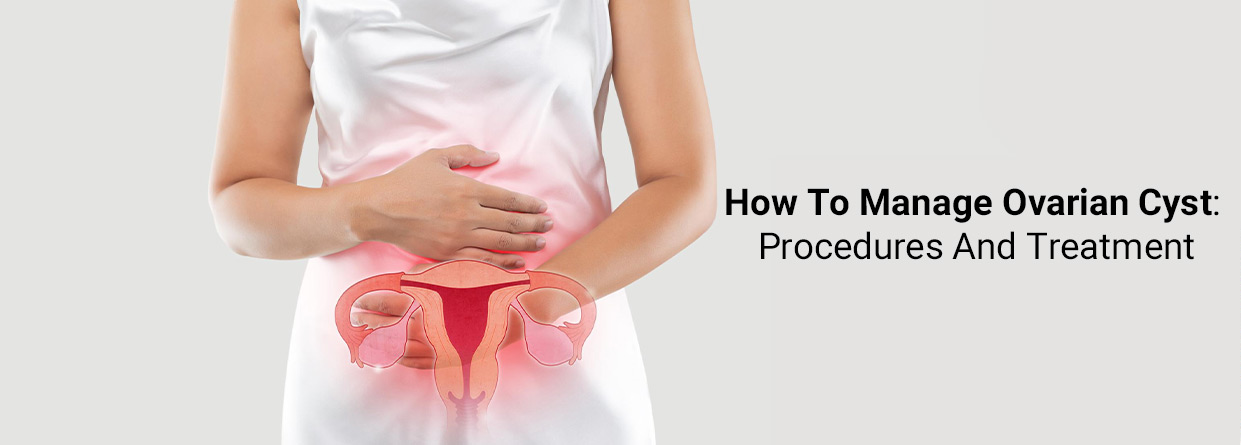 How To Manage Ovarian Cyst: Procedures And Treatment