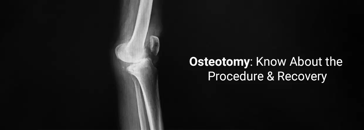 Osteotomy: Know About the Procedure & Recovery