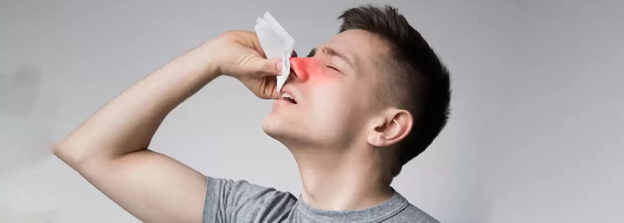 Stop your nosebleeds with these tips expert says