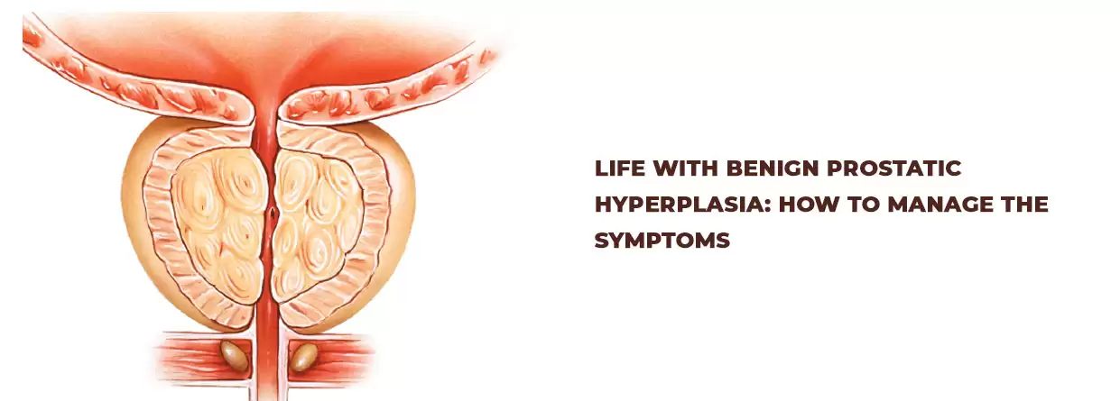 Life with Benign Prostatic Hyperplasia: How to manage the symptoms
