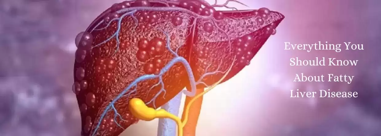 Everything You Should Know About Fatty Liver Disease