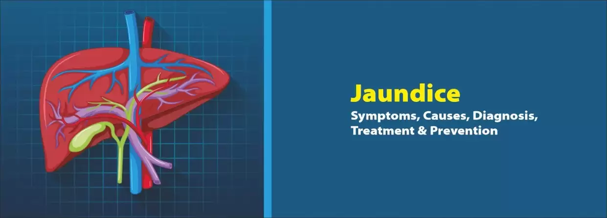 Jaundice: Symptoms, Causes, Diagnosis, Treatment & Prevention