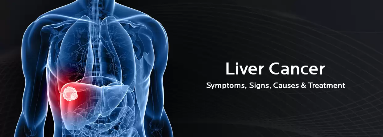 Understanding Liver Cancer: Symptoms, Causes, Stages, Types, and Treatment Methods