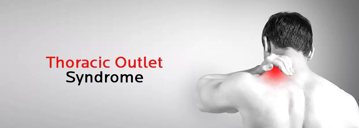 Thoracic Outlet Syndrome- Everything You Need to Know