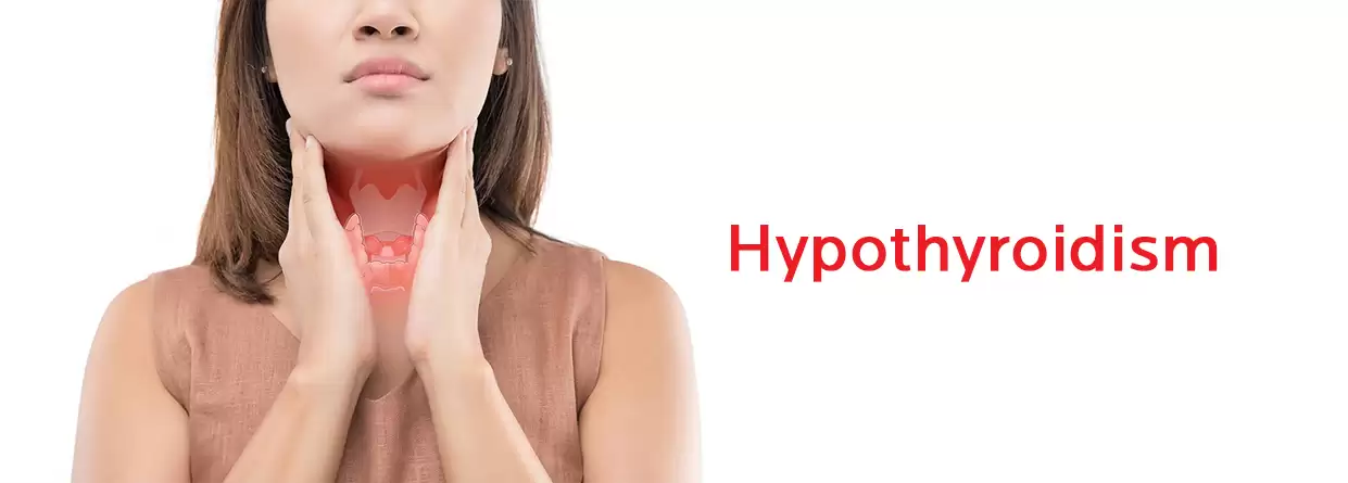 Everything You Need to Know About Hypothyroidism