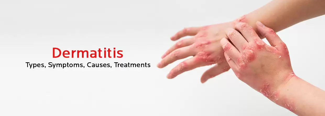 Dermatitis Demystified: Everything You Need to Know