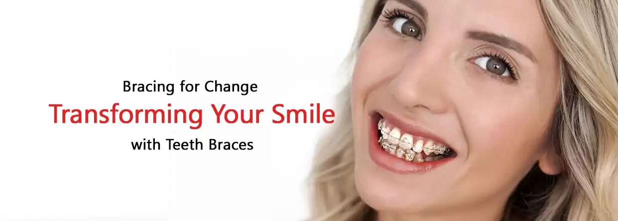 Bracing for Change: Transforming Your Smile with Teeth Braces