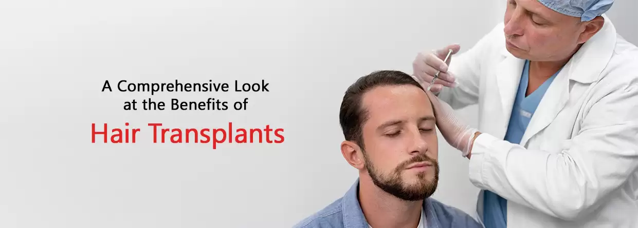 A Comprehensive Look at What You Must Know About Hair Transplants