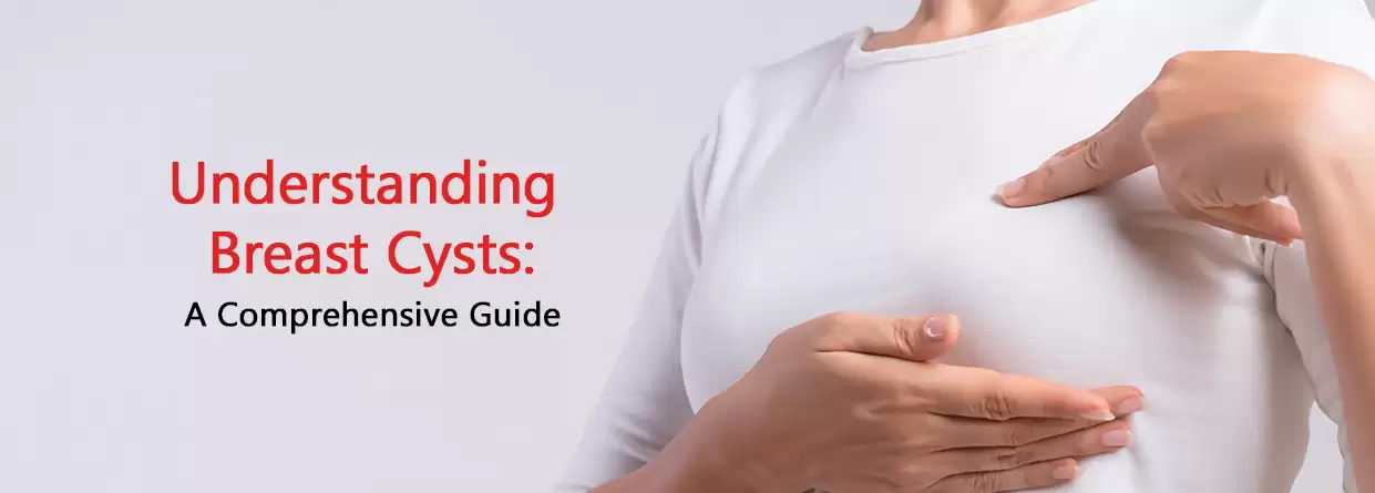 Understanding Breast Cysts: A Comprehensive Guide