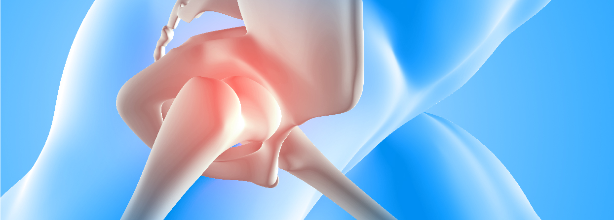 Minimally Invasive Knee & Hip Replacement Surgery