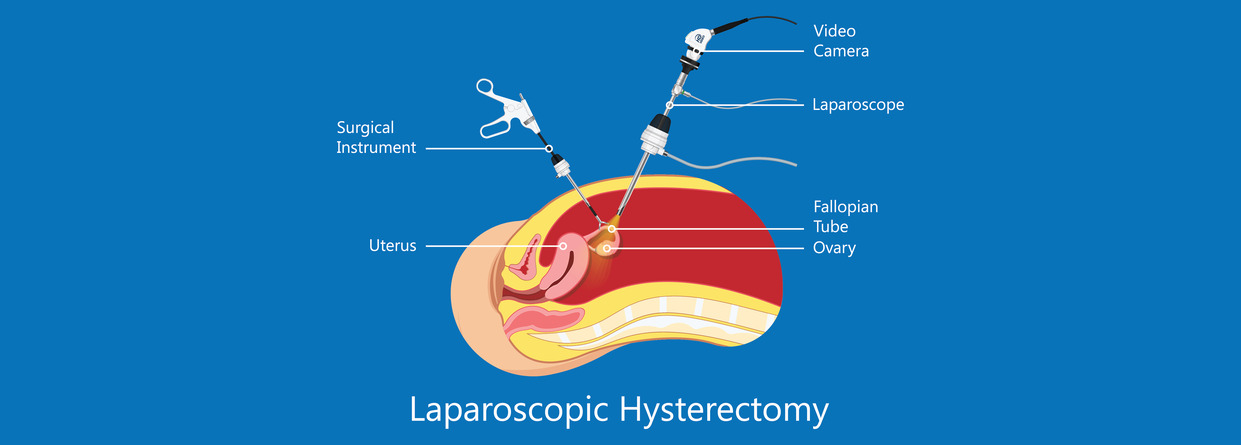 A Complex Case of laparoscopic hysterectomy