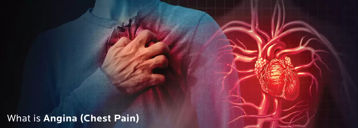 What Should You Know About Angina?