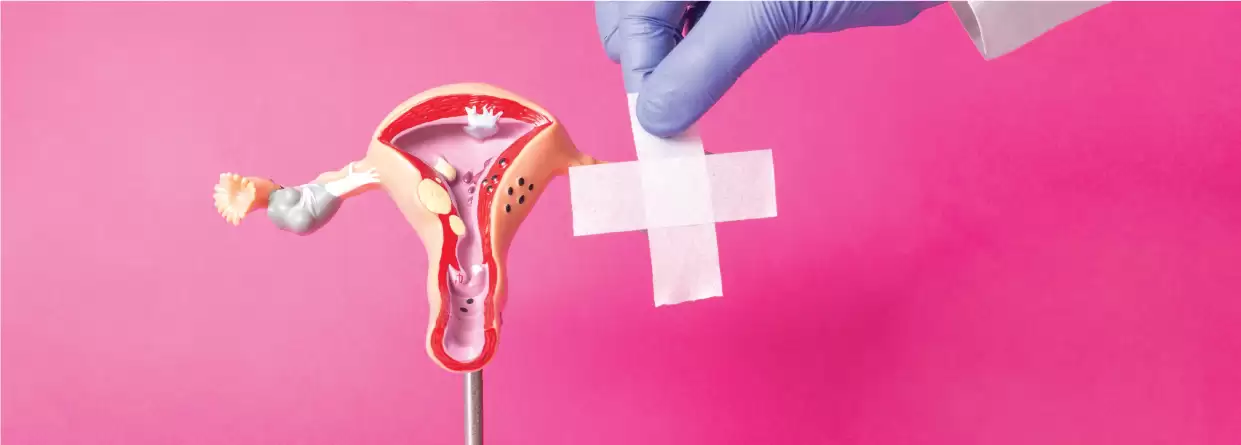 Uterine Prolapse - Early Warning Signs & Treatment options