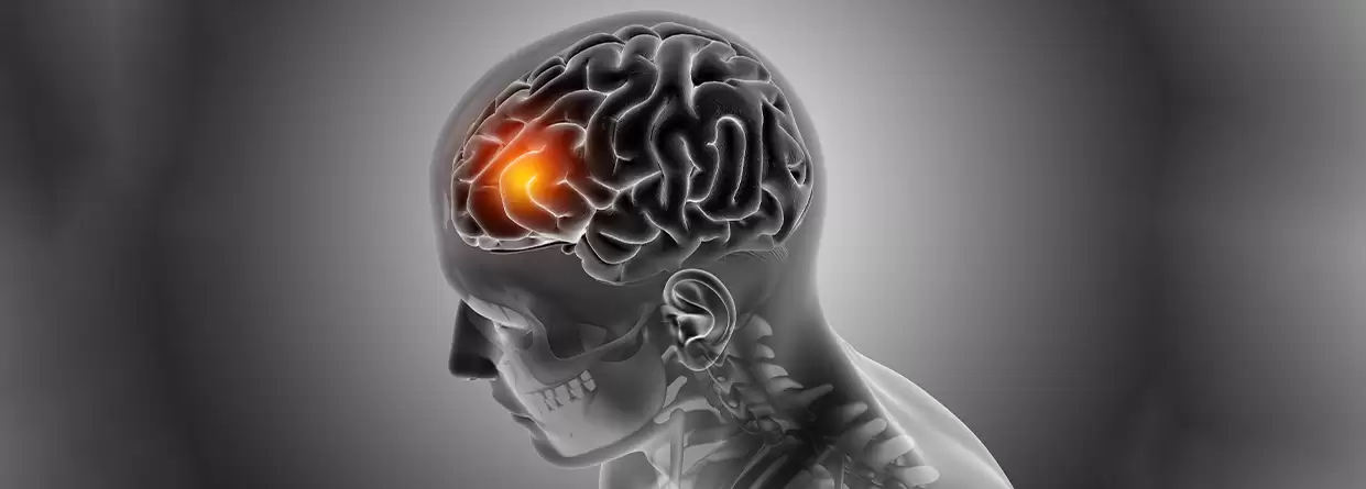Is craniotomy for brain tumors a safe procedure?
