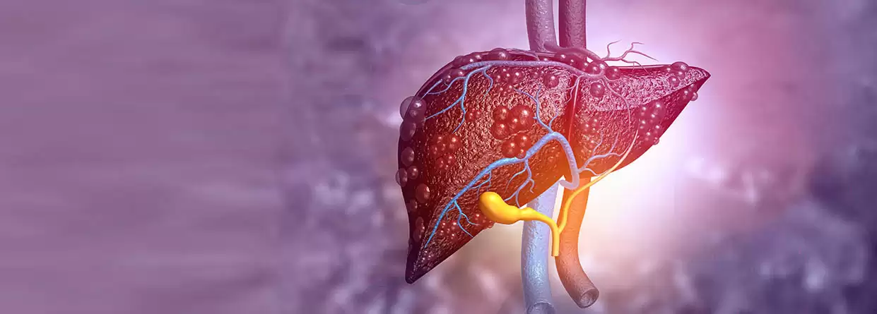 Fatty Liver: Causes, Symptoms And Diagnosis