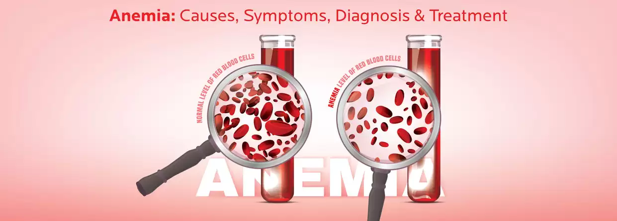 What All You Need to Know About Anaemia?