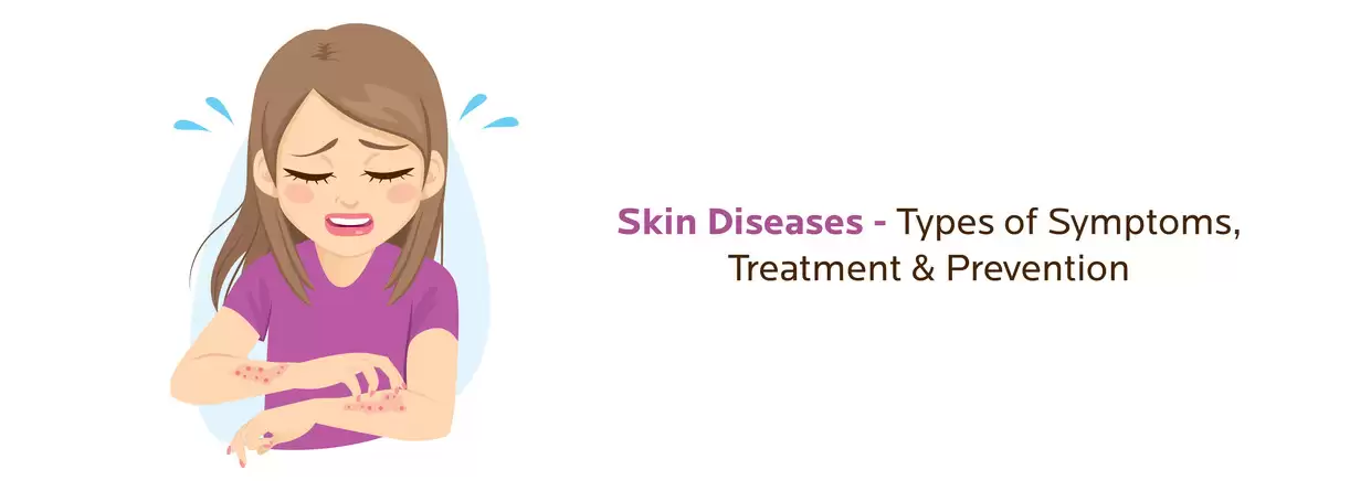Skin Diseases: Types of, Symptoms, Treatment & Prevention