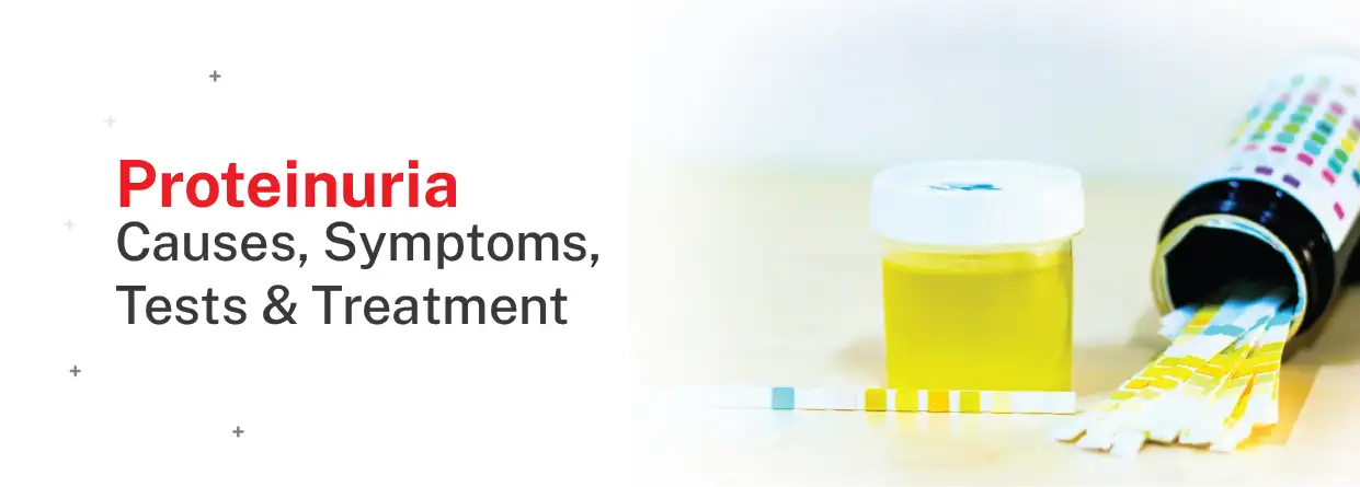 Proteinuria: Causes, Symptoms, Tests & Treatment